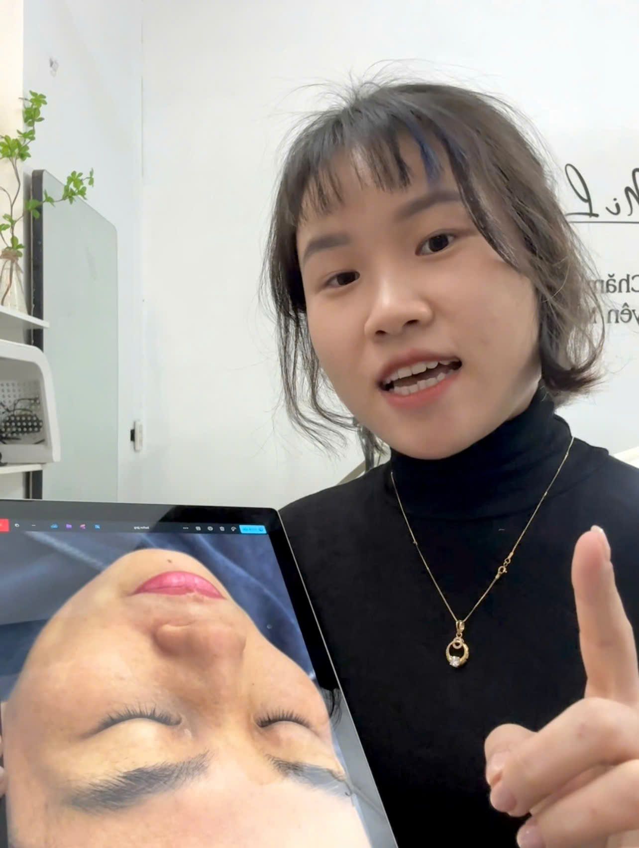 Kỹ thuật viên MiLa tư vấn tình trạng da mụn cho khách